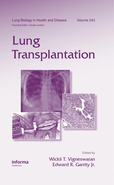 Book - Lung Transplantation edited by Doctor Wickii T. Vigneswaran